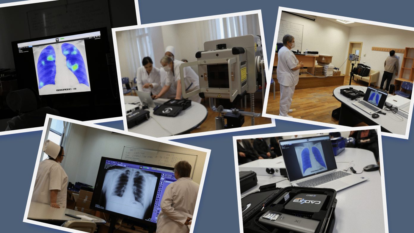 Impulsadas por el software de inteligencia artificial CAD4TB (detección asistida por computadora para la tuberculosis), las unidades de rayos X ultraportátiles están ampliando el acceso a la atención especializada en zonas remotas de Turkmenistán. Con el apoyo del Fondo Mundial, esta tecnología permite realizar cribados rápidos y precisos que facilitan la detección de posibles casos para su posterior seguimiento.